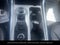 2023 Ford Explorer XLT ADAPTIVE CRUISE CONTROL